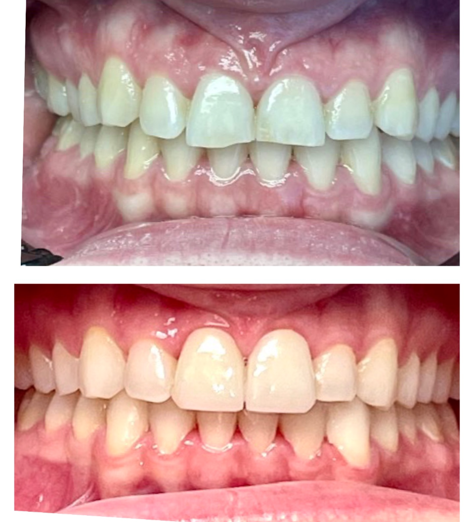 Regency Family Dental | Dentures, Preventative Program and Veneers