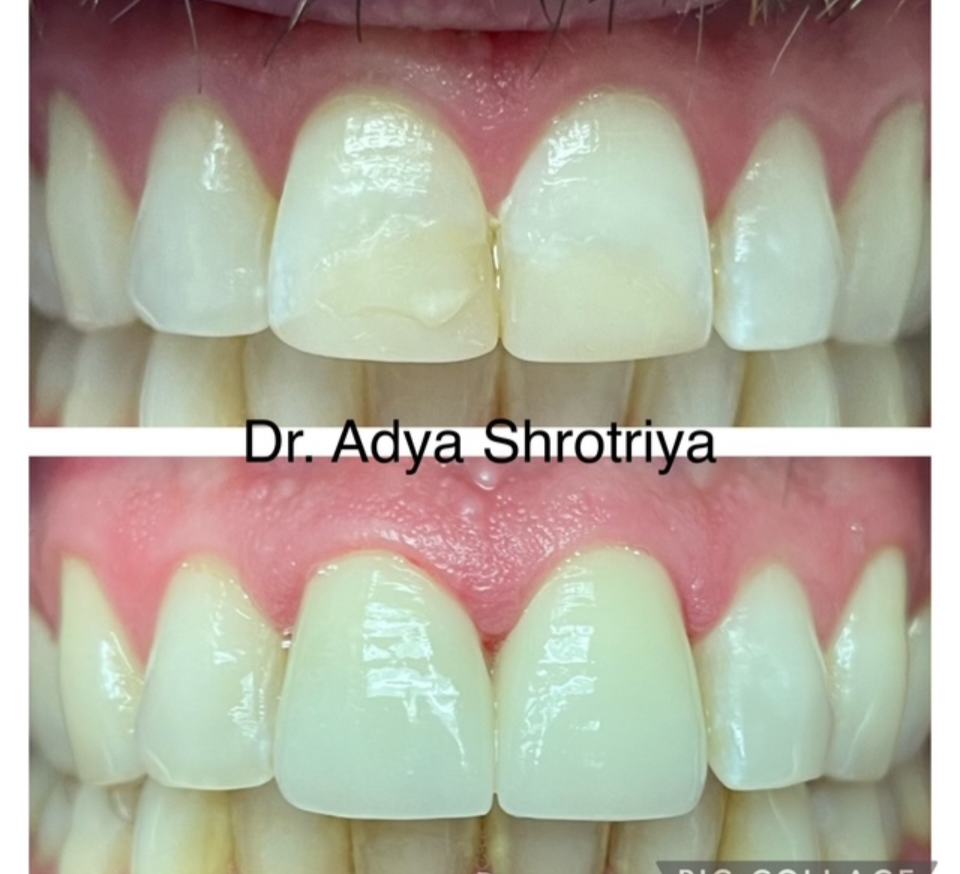 Regency Family Dental | Sedation Dentistry, Implant Dentistry and Extractions