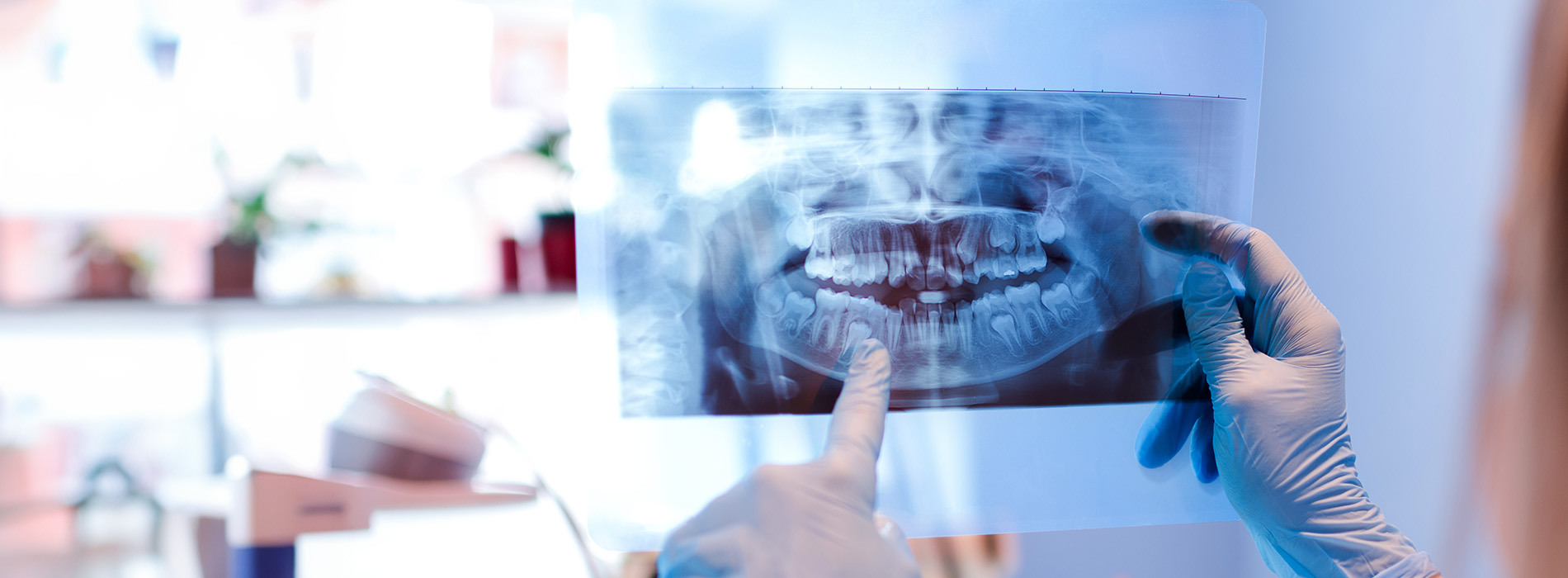 A person holding up a transparent dental X-ray film, showcasing a toothpaste advertisement with a dentist s hand visible in the foreground.