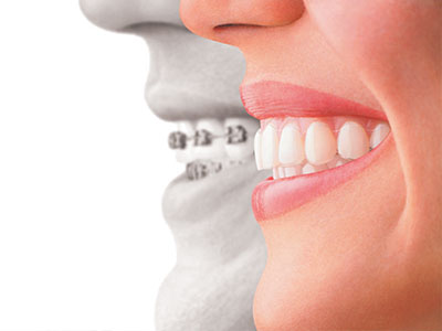 The image features a split-screen representation with a smiling woman on the left side and a dental implant on the right, suggesting the transformation of teeth through dental implants.