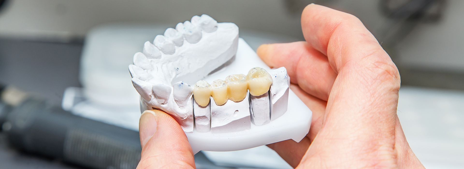 The image shows a person holding a model of human teeth with visible roots and gums, which appears to be used for dental education or demonstration purposes.