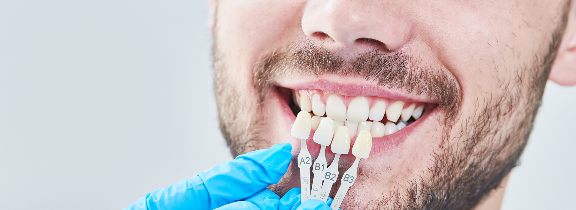 The image features a man with a toothy smile, wearing a blue surgical mask and holding dental implants in his mouth.